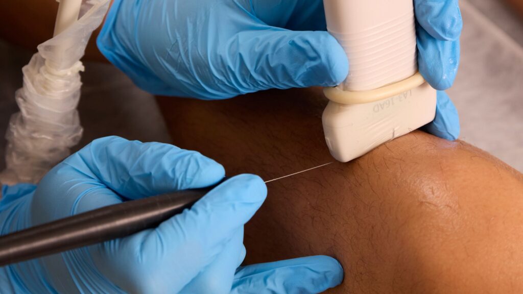 Terapias biológicas: PRP y Ácido Hialurónico Tratamientos médicos avanzados para el dolor articular